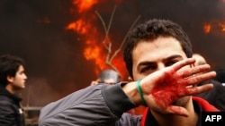 An Iranian opposition protester covers his face with his bloodstained hand during clashes with security forces in Tehran on December 27.