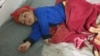 A child suffering from measles at a Badghis hospital in February.