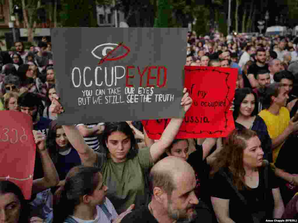 A protester holds a sign in reference to demonstrators who lost their eyes in violence or were temporarily blinded by tear gas during clashes with police on June 20. Police used rubber bullets and tear gas against the crowd, with hundreds of people being injured, including many police. &nbsp;